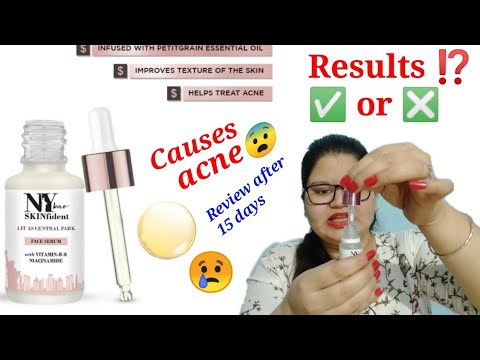NY Bae vitamin B and niacinamide face serum review | For acne | Beauty Petals