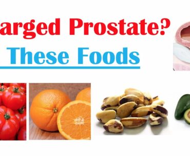 Best Foods to Eat with Enlarged Prostate | Reduce Risk of Symptoms, Enlargement & Cancer
