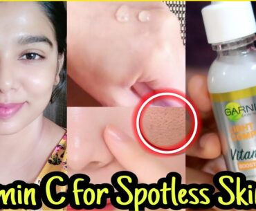 How to Use Garnier VITAMIN C SERUM for youthful, glowing,spotless skin || My Skin care essentials