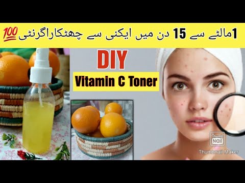 Beauty Vlog/Vitamin C Toner Remedy/Oily Skin/Homemade/Orange Toner/Acne prone skin care#diy