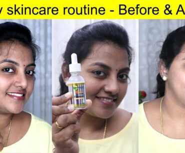 My skincare routine | How to use Garnier Vitamin C serum | Karthikha Channel Beauty Series