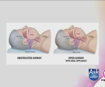 Center for Sleep Apnea & TMJ discusses ways to boost your immune system