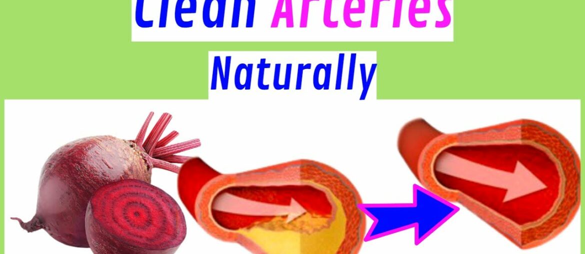 10 Foods That Clear Arteries Naturally | And Protect Your Heart