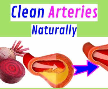10 Foods That Clear Arteries Naturally | And Protect Your Heart