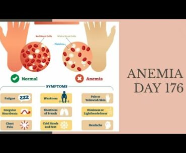 Anemia I Day 176