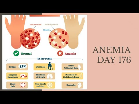 Anemia I Day 176