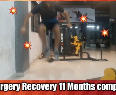 Acl Surgery Recovery 11 Months completed | Gym After Acl Surgery | Gym After Acl Reconstruction |