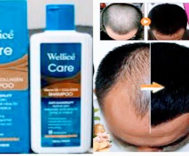 Wellice Care Shampoo | welice Care Vitamin B5 Shampoo | Wellice Care collagan Shampoo