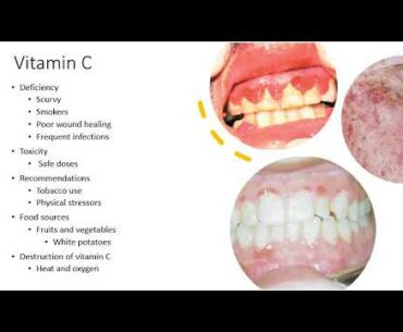 Nutrition   Chap 07d   Vitamin C and B Vitamins 20201017