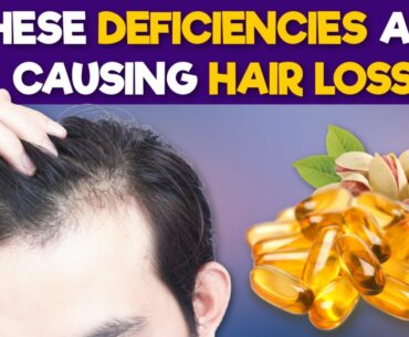 6 Nutritional Deficiencies That Cause Hair Loss