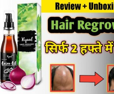 Ryaal onion oil for Hair Regrowth | ryaal onion oil review | ryaal onion oil results | Vipin YouTech