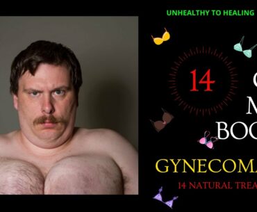 How To Naturally Eliminate Your Man Boobs (14 Gynecomastia Treatments)