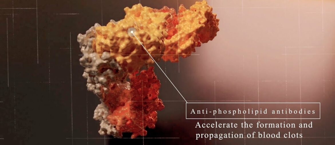 Long-term Coronavirus Complications-AutoAntibodies, Latest Covid-19 research.