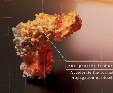 Long-term Coronavirus Complications-AutoAntibodies, Latest Covid-19 research.