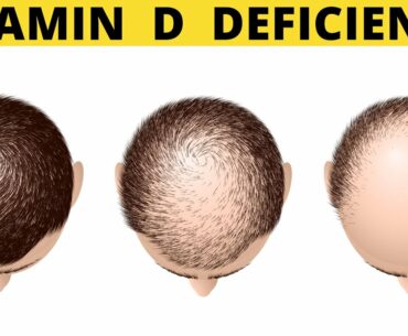 SYMPTOMS OF VITAMIN D DEFICIENCY | DEPRESSION | HAIR LOSS |  SILVA GUIDE |