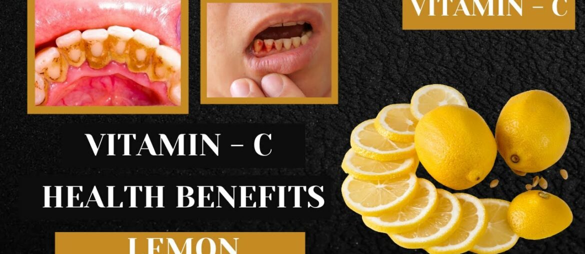 How To Get Vitamin - C For Lemon - Lemon Health Benefits - Natural Way To Get Vitamin - C