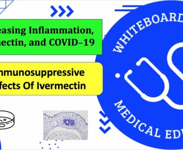 Ivermectin And Decreased Inflammation In COVID-19 [Immunosuppression In Inflammatory Phase COVID-19]