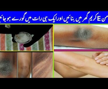 How To Get Rid of Dark Knees and Elbows with Vitamin E homemade cream|| Overnight Result 100%