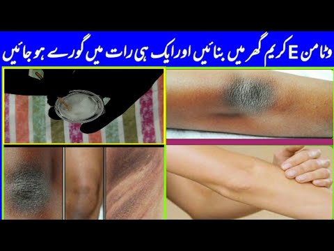 How To Get Rid of Dark Knees and Elbows with Vitamin E homemade cream|| Overnight Result 100%