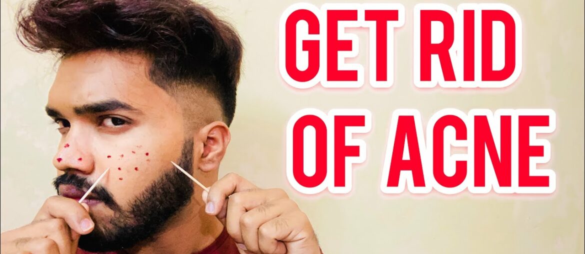 GET RID OF ACNE COMPLETELY | In Telugu | Ravinder’s Fashion