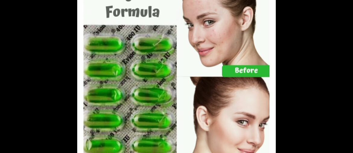 top:6 uses of vitamin E capsule for skin,hair & lips (benefits of vitamin E)