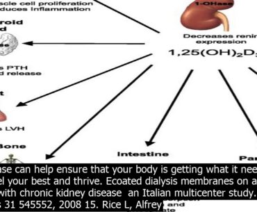 Chronic kidney disease treatment vitamin co.nsidering taking a vitamin or supplement to tre