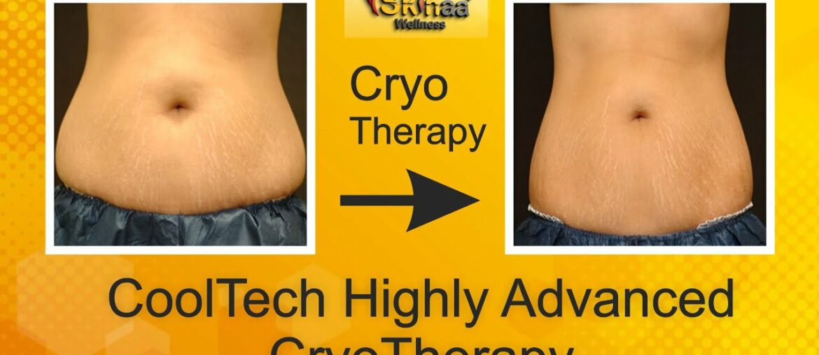 CoolTech Highly Advanced Cryo Therapy | Skinaa Wellness