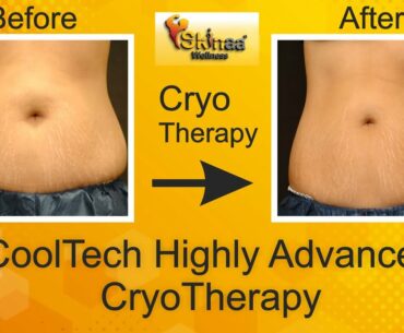 CoolTech Highly Advanced Cryo Therapy | Skinaa Wellness