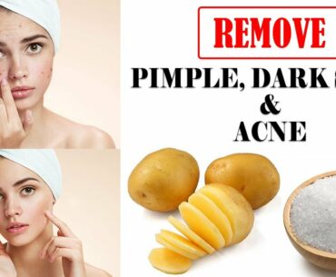 Skin Whitening serum || Potato serum ||