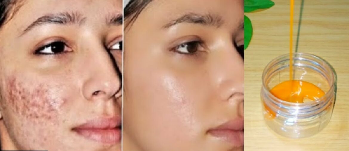 How to make DIY VITAMIN C FACE PACK at home for Spotless skin, Anti-Aging Pack, Skin Whitening, Acne
