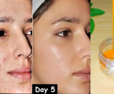 How to make DIY VITAMIN C FACE PACK at home for Spotless skin, Anti-Aging Pack, Skin Whitening, Acne
