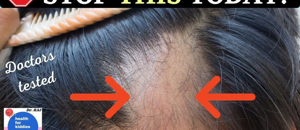 ONE VITAMIN FOR HEALTHY HAIR | Dr. Raj
