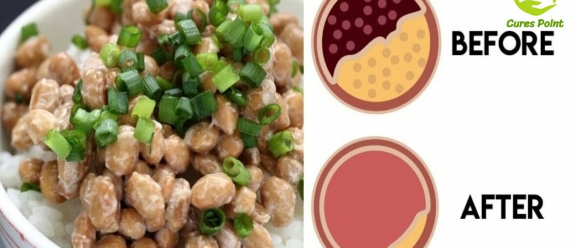 Natto 3 Nutrition Benefits You Should Know