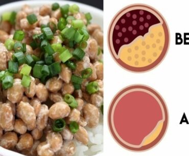 Natto 3 Nutrition Benefits You Should Know