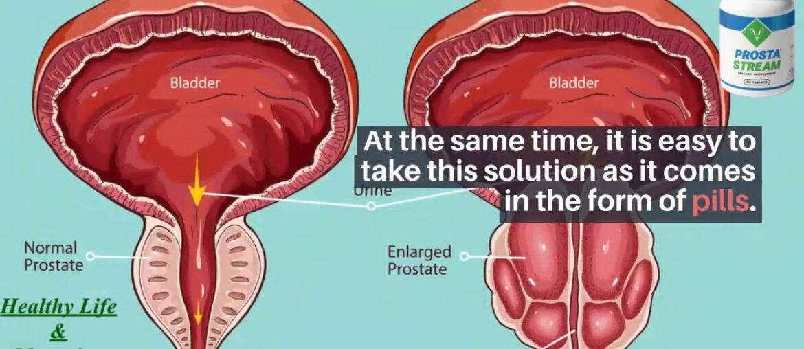 ProstaStream 2021 Review the Healthy Prostate Support Supplement