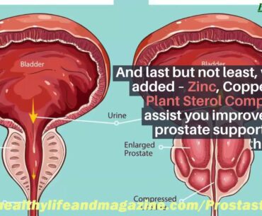 ProstaStream Ingredients Does ProstaStream Ingredients Really Work?