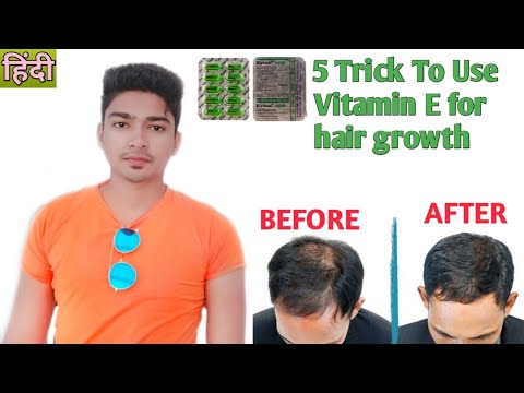 5 Trick To Use Vitamin E Capsule For hair growth and hair fall Rescue | in Hindi
