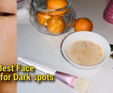 Apply this vitamin C mask-Remove dark spots,hyperpigmentation &get instant spotless brightening skin