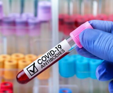 IgM and IgG antibodies represent different stages of an immune response against COVID-19