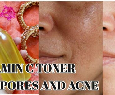 Vitamin C Toner For Pores And Ances | Best For Glowing Skin | Only 2 Ingredients Beauty Remedy