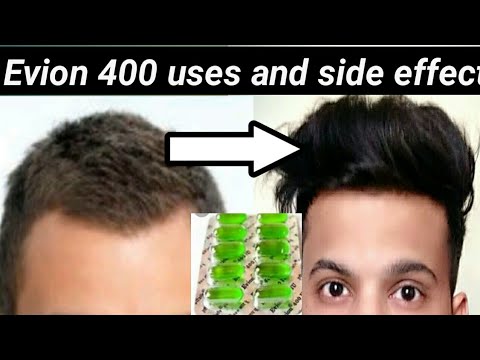 How to Use VITAMIN E capsule for HAIRGROWTH,SKIN and Health[EVION 400 uses]|EVION 400|VITAMINE E