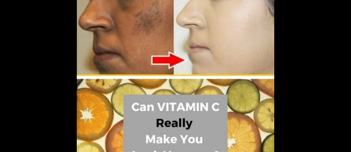can vitamin c really make u look younger?vitamin c home remedies serum uses benefits richest source