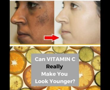 can vitamin c really make u look younger?vitamin c home remedies serum uses benefits richest source
