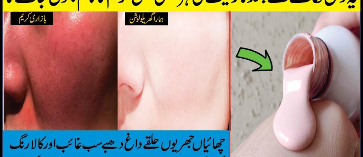 5 Star Rating LOTION For Whole Skin Whitening At Home: Beauty Tips At Home: How To Make Lotion