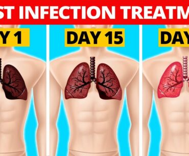 7 Natural Chest Infection Treatments (Home Remedies)