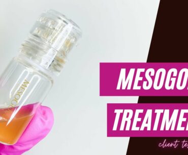 MesoGold Client Testimonial at Wellness Centre 4 You