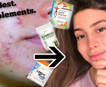 THE BEST SUPPLEMENTS FOR CLEAR AND GLOWY SKIN!! || MSM, Vitamin D, and more..