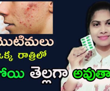 remove pimples & Lighten your Skin with Vitamin E Captules telugu || Beauty tips telugu