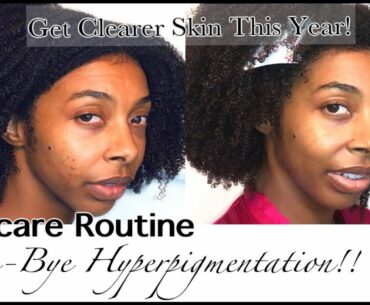 Skincare Routine w/ Ambi To Reduce Dark Marks & Inflammation | Post Inflammatory Hyperpigmentation