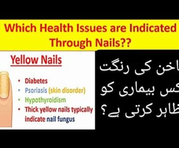 Which Health Issues are Indicated Through Nails? | Diseases | World of Biological Science